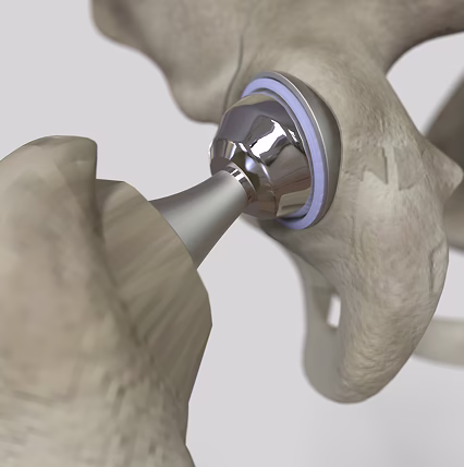 Применение Автоклав для композитных материалов в медицинской промышленности